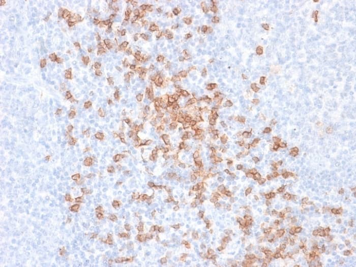 Anti-CD8 alpha antibody [rC8/468](AB237941)