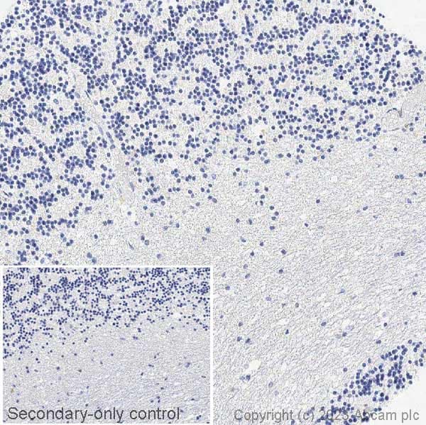 Anti-Ctip2 antibody [EPR23120-25](AB240636)