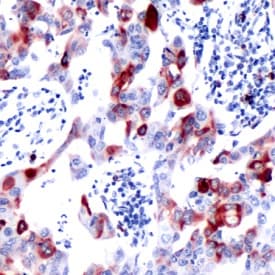 Rps6 Phospho S240 S244 Antibody Sp45 Ab81081  Immunohistochemistry Formalin Pfa Fixed Paraffin Embedded Sections Img92415