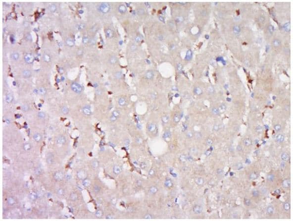 Abcb11 Bsep Antibody Ab217532  Immunohistochemistry Formalin Pfa Fixed Paraffin Embedded Sections Img123078