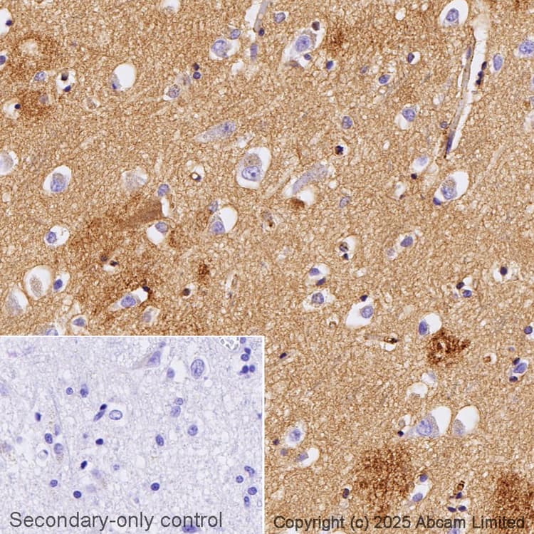 Anti-Apolipoprotein E antibody [EP1374Y](AB52607)