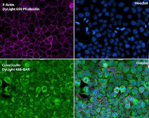 Anti-Calreticulin antibody - ER Marker(AB2907)