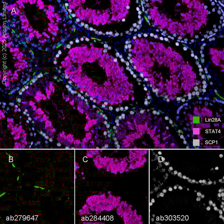 Anti-STAT4 antibody [EPR25128-48](AB284408)