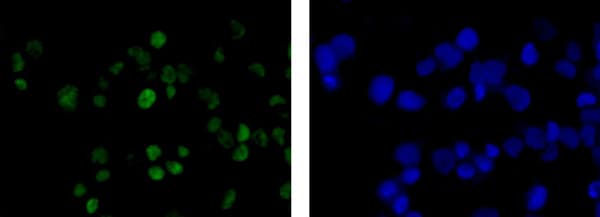 Anti-Wilms Tumor Protein antibody [CAN-R9(IHC)-56-2] - BSA and Azide free(AB216646)