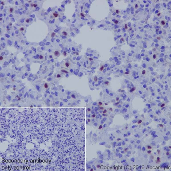 Anti-TTF1/Nkx2-1 antibody [EP1584Y](AB76013)