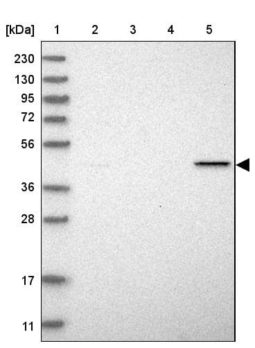Anti-NAPE-PLD antibody(ab246951)