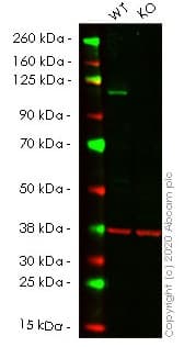 Anti-PMS2 antibody [EPR3947](AB110638)