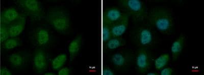 Mtf1 Antibody Ab183897  Immunocytochemistry Immunofluorescence Img110642