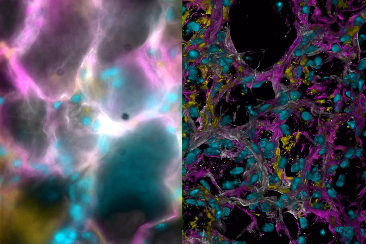 Mouse Lung Tissue Stained For A Study Of Type I Alveolar Epithelial Cell AT1 Biology Kid21768021