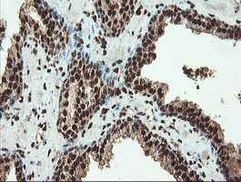 Samhd1 Antibody Oti1a1 Ab128107  Immunohistochemistry Formalin Pfa Fixed Paraffin Embedded Sections Img61913