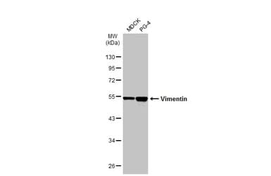 Anti-Vimentin antibody(AB137321)
