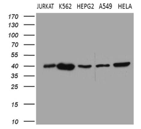 Anti-CerS2 antibody [OTI3D9](AB279372)