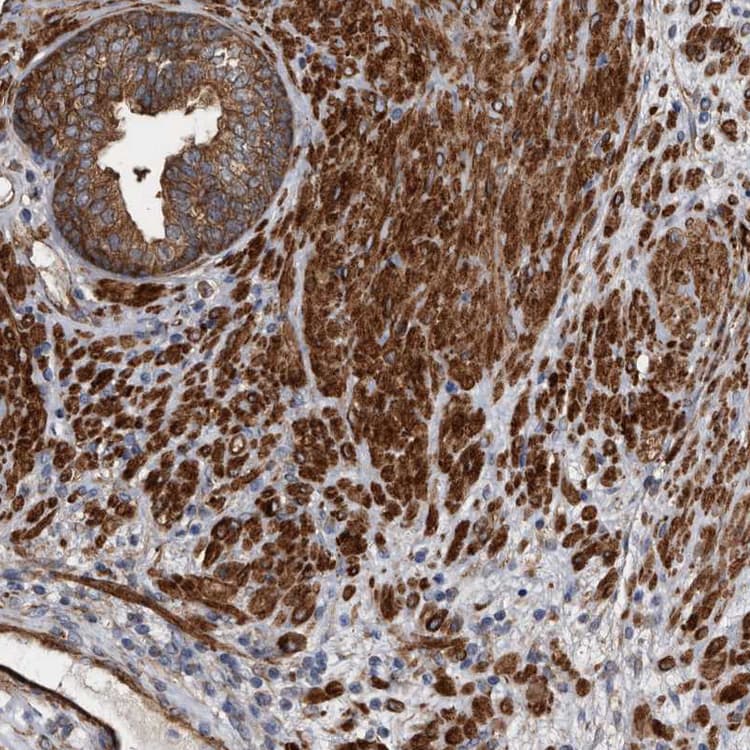 Kctd20 Antibody Ab122094  Immunohistochemistry Formalin Pfa Fixed Paraffin Embedded Sections Img62434