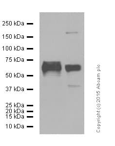 Anti-MMP2 antibody [EPR1184](AB92536)
