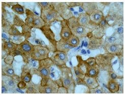 Cyp26a1 Antibody Epr11841 Ab172474  Immunohistochemistry Formalin Pfa Fixed Paraffin Embedded Sections Img77666