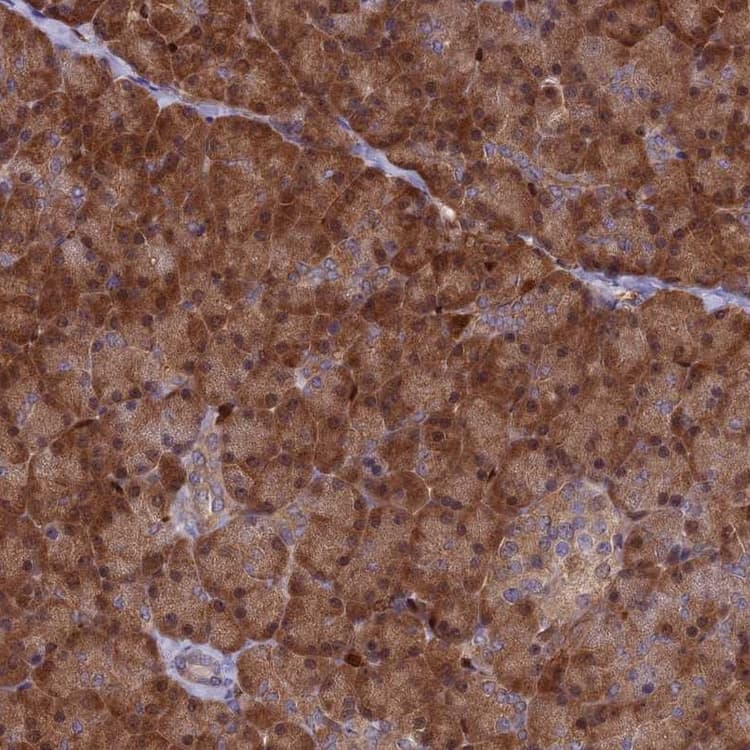 Arhgap18 Antibody Ab262926  Immunohistochemistry Formalin Pfa Fixed Paraffin Embedded Sections Img10537
