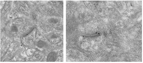 Anti-Metabotropic Glutamate Receptor 5 antibody [EPR2425Y] - BSA and Azide free(ab256589)