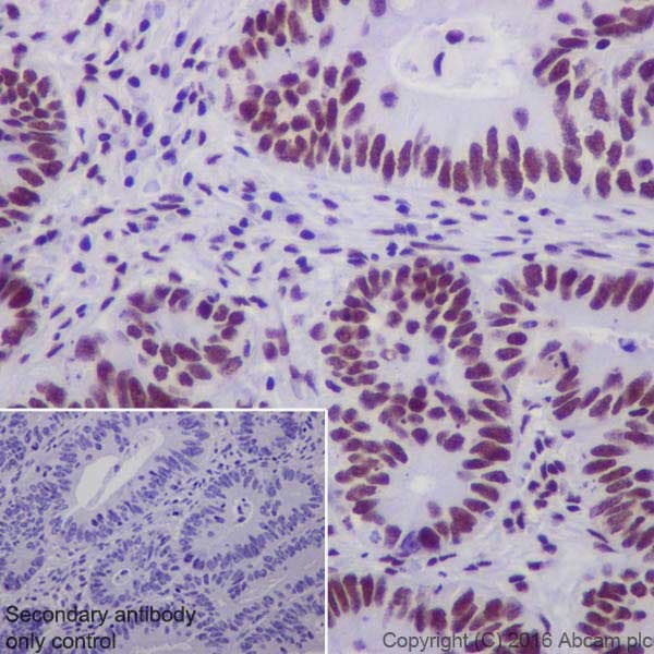 Anti-DBC-1 antibody [EPR19747] - BSA and Azide free(AB223530)
