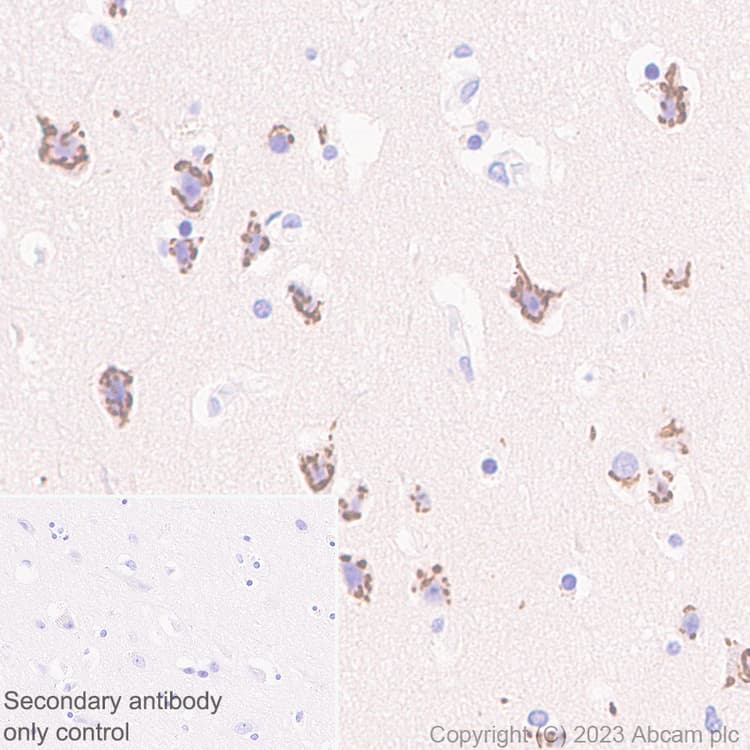 B4galnt1 Antibody Epr28064 64 Ab314130  Immunohistochemistry Formalin Pfa Fixed Paraffin Embedded Sections Img419996