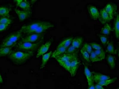 Anti-Mannosidase II/MAN2A1 antibody(ab224611)