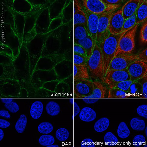 Trop2 Antibody Epr20043 Ab214488 Immunocytochemistry Immunofluorescence Img76594