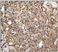 Eif5a Antibody Ep527y Bsa And Azide Free Ab247255  Immunohistochemistry Formalin Pfa Fixed Paraffin Embedded Sections Img83859