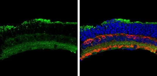 Activin Receptor Type Ia Antibody Ab262699  Immunohistochemistry Frozen Sections Img14367