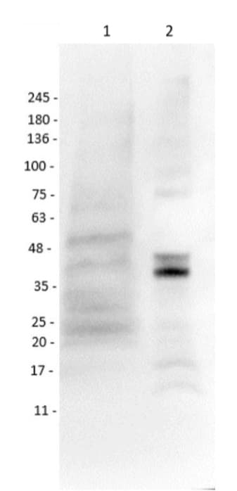 Anti-MASH1/Achaete-scute homolog 1 antibody(AB235198)