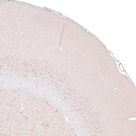 Anti-FOXP2 antibody [CL5312](AB243038)