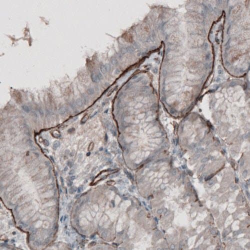 Anti-Laminin alpha 5/LAMA5 antibody [CL3118](AB210957)