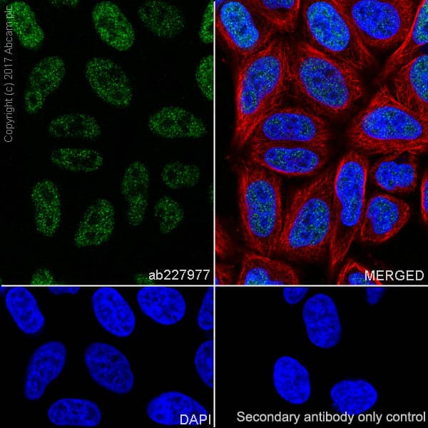 Anti-FOXC1 antibody [EPR20685](ab227977)
