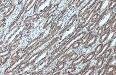 Anti-VDAC2 antibody - C-terminal(AB155803)