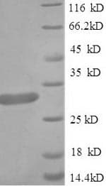 Recombinant Human Apolipoprotein CIII (Tagged)(AB235684)