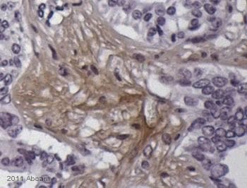 Anti-Cannabinoid Receptor I antibody(AB23703)