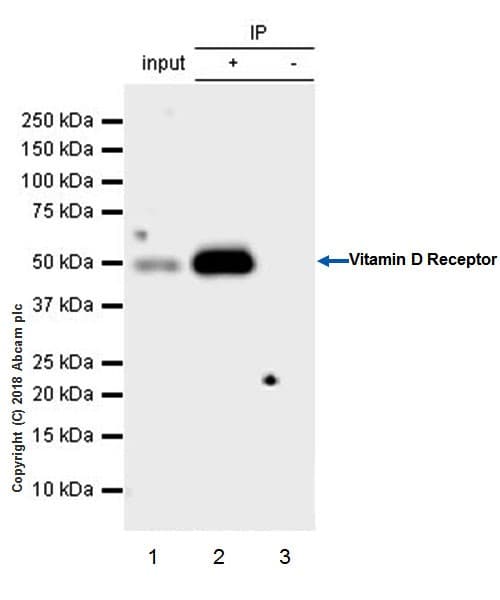 Anti-Vitamin D Receptor antibody [EPR4552] - ChIP Grade(AB109234)