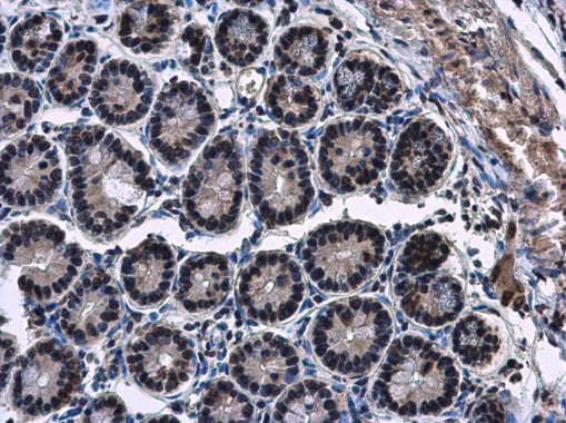 Anti-HP1 gamma/CBX3 antibody(AB227478)