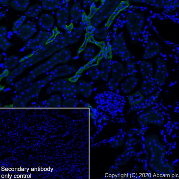 Casr Antibody Epr24050 59 Bsa And Azide Free Ab280360  Immunohistochemistry Frozen Sections Img115066