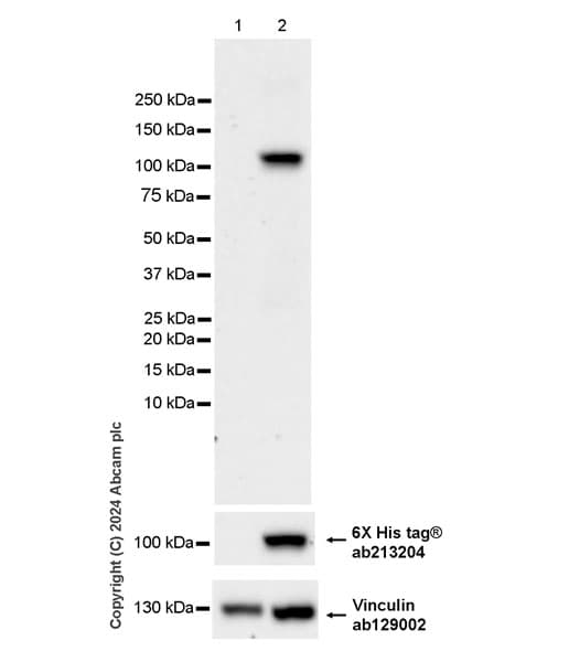 Anti-Adenovirus Type 5 Hexon antibody [EPR28237-57](AB316852)