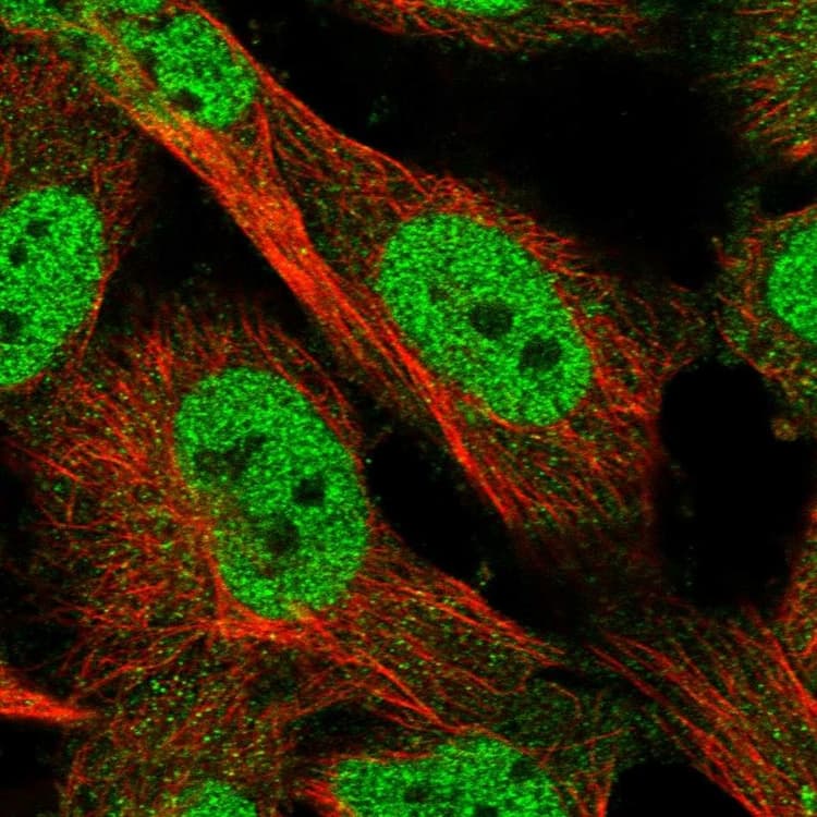 Klhdc3 Antibody Ab272605  Immunocytochemistry Immunofluorescence Img109678