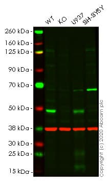 Anti-Vitamin D Receptor antibody [EPR4552] - ChIP Grade(AB109234)