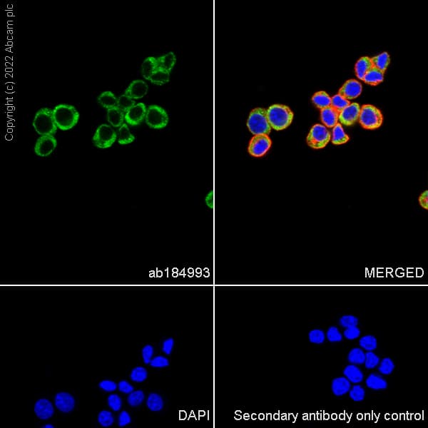 Anti-Collagen III antibody [EPR17673](AB184993)