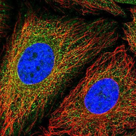 Ganp Antibody Ab222058  Immunocytochemistry Immunofluorescence Img76762