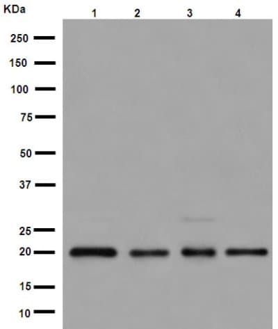 Anti-UFC1 antibody [EPR15014](AB189251)