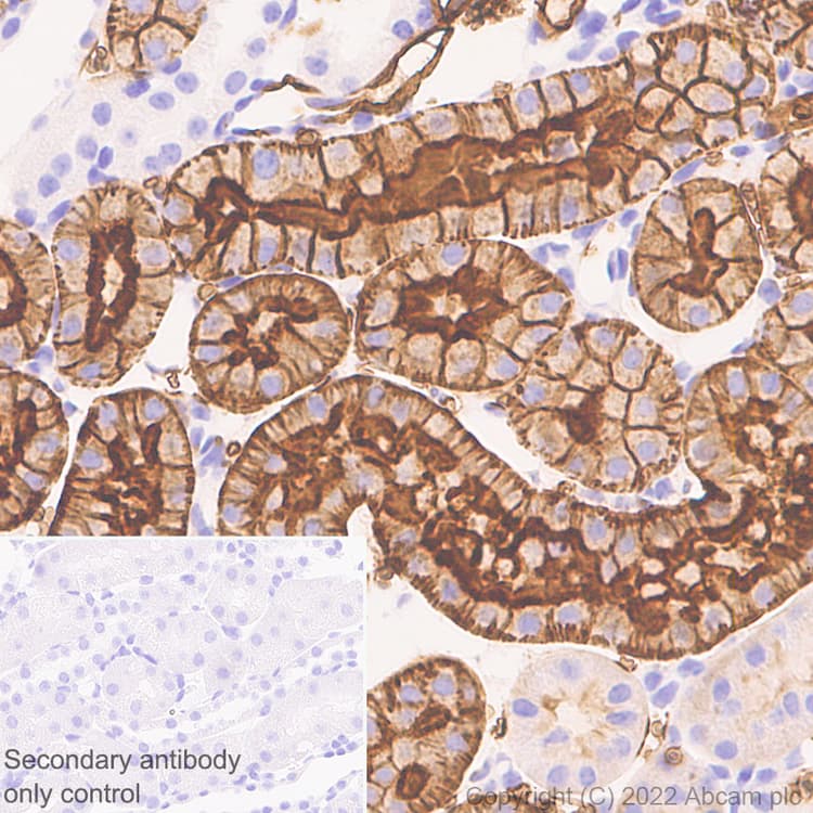 Aquaporin 1 Antibody Epr26554 46 Bsa And Azide Free Ab300464  Immunohistochemistry Formalin Pfa Fixed Paraffin Embedded Sections Img400423