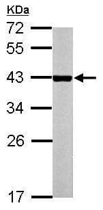 Constitutive Androstane Receptor Antibody Ab228767  Western Blot Img142866