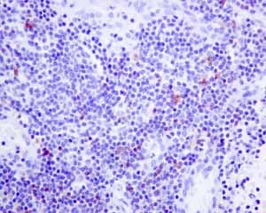 Il 2 Receptor Alpha Antibody Epr6452 Ab128955  Immunohistochemistry Formalin Pfa Fixed Paraffin Embedded Sections Img78687