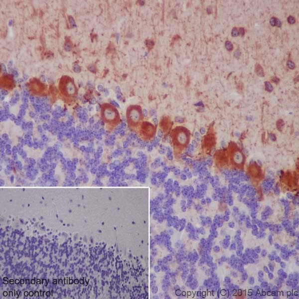 Anti-GAD65 + GAD67 antibody [EPR19366](AB183999)