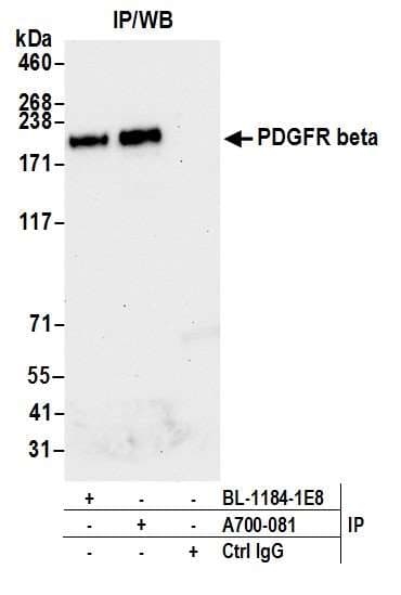Anti-PDGFR beta antibody [BLR081G] - BSA free(AB314096)