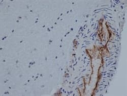 Anti-CD31 antibody [TLD-3A12](ab64543)