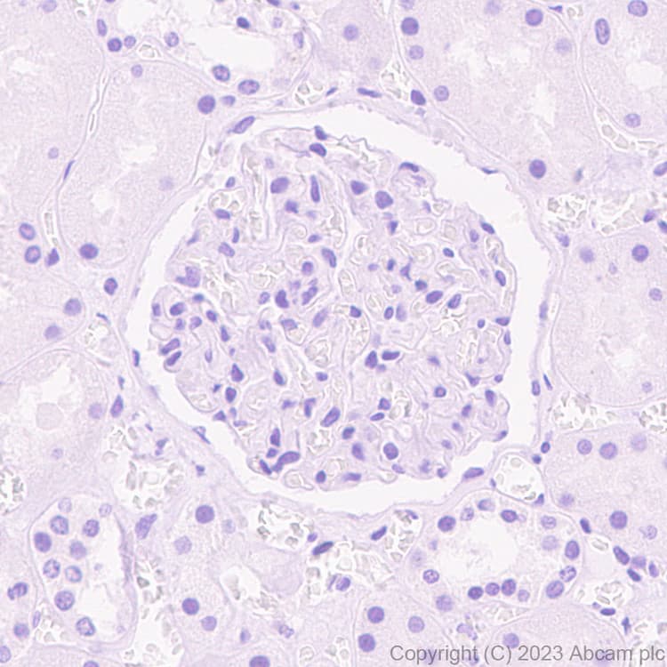 Arx Antibody Epr27481 32 Ab308260  Immunohistochemistry Formalin Pfa Fixed Paraffin Embedded Sections Img408871